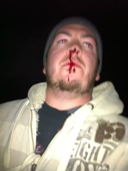 bloodynose.jpg