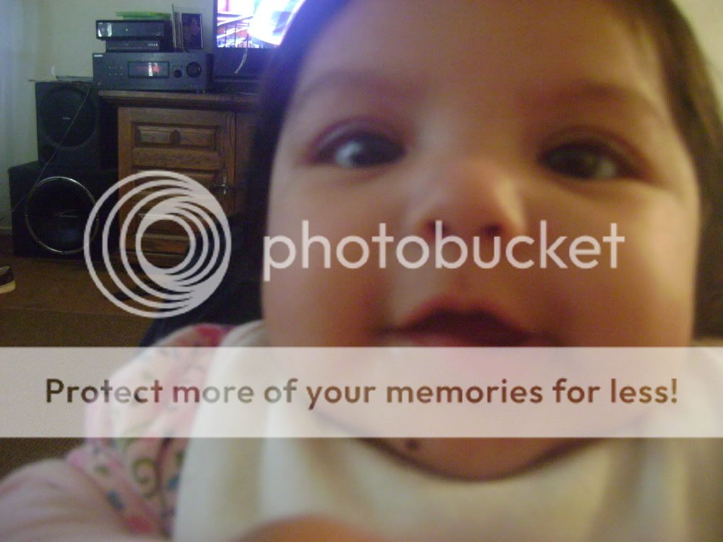 babies with moles.. - Page 2 - BabyCenter